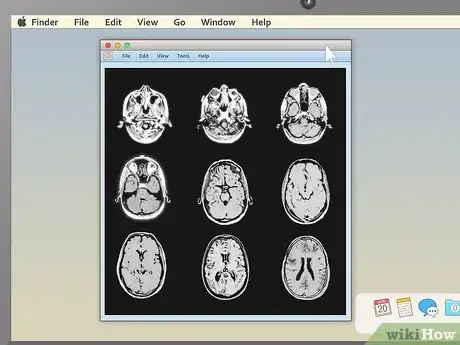 Imagen titulada Read an MRI Step 8