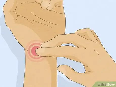 Imagen titulada Check Blood Pressure with No Cuff Step 2