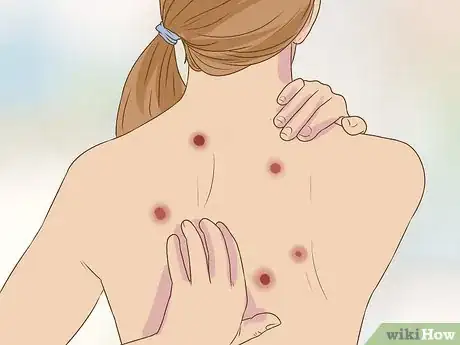 Imagen titulada Get Rid of Sandfleas Step 2