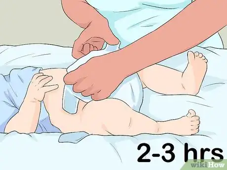 Imagen titulada Clean a Circumcision Step 3