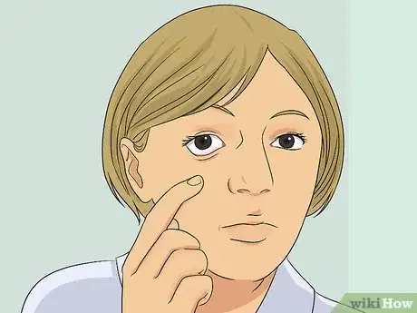 Imagen titulada Put In and Take Out Contacts Step 10
