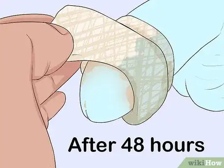 Imagen titulada Clean a Circumcision Step 7