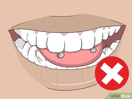 Imagen titulada Reduce Tongue Swelling Step 14