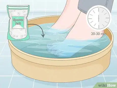 Imagen titulada Treat a Sore Toe Step 4