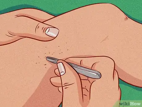 Imagen titulada Get Rid of Unwanted Hair Step 8