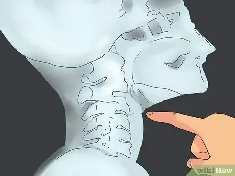 Imagen titulada Get a Fish Bone Out of Your Throat Step 3