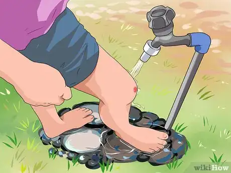 Imagen titulada Heal a Skinned Knee Step 4