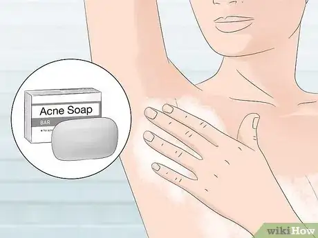 Imagen titulada Stop Armpit Pimples Step 11