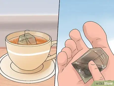 Imagen titulada Heal Blisters Step 8