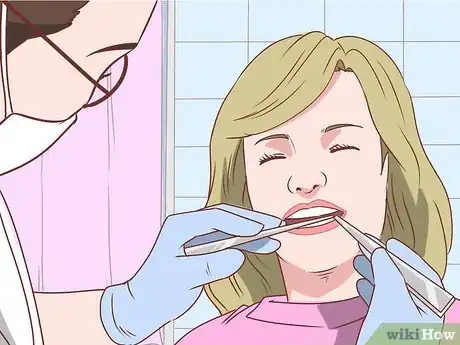 Imagen titulada Straighten Your Teeth Without Braces Step 10