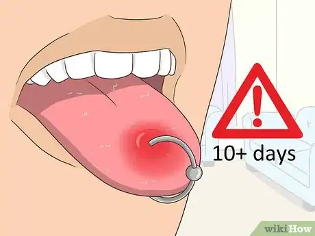 Imagen titulada Reduce Tongue Swelling Step 18