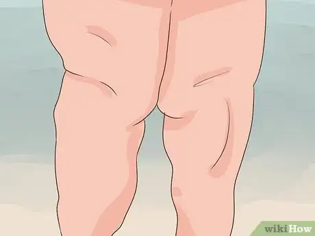 Imagen titulada Diagnose Lipedema Step 4