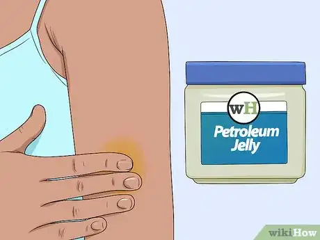 Imagen titulada Get Rid of a Scab Step 3