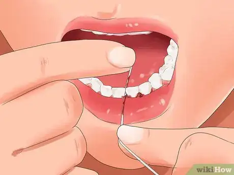 Imagen titulada Get Pink Gums Step 11