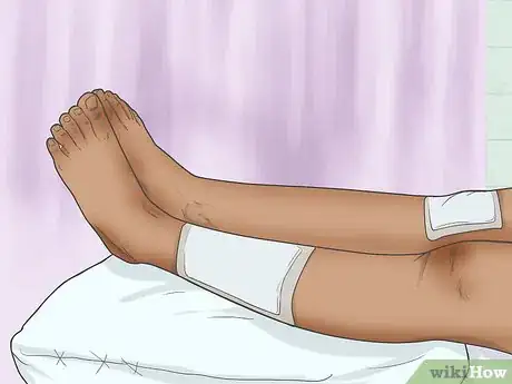 Imagen titulada Treat a Turf Burn Step 3