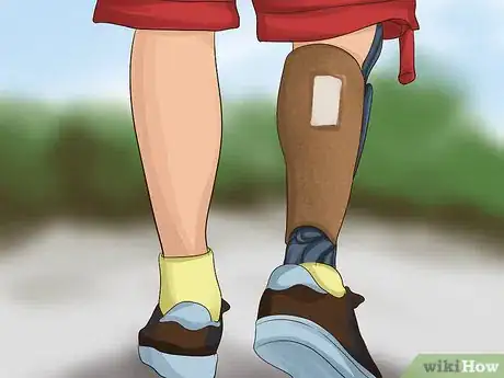 Imagen titulada Wear a Prosthesis Step 4