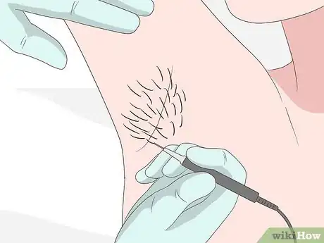 Imagen titulada Remove Armpit Hair Step 35
