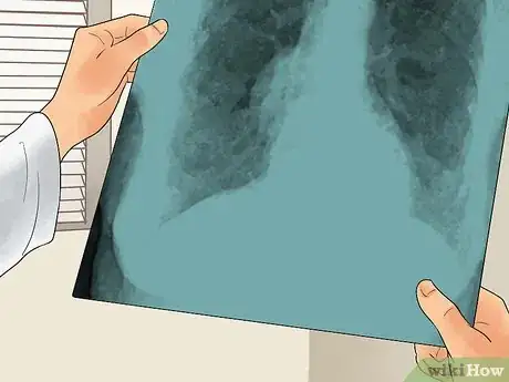 Imagen titulada Diagnose a Thymoma Step 12