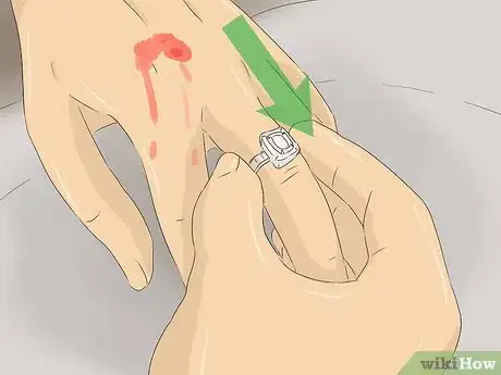 Imagen titulada Treat a Rattlesnake Bite Step 5