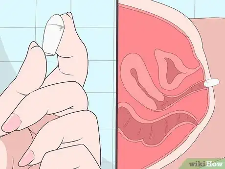 Imagen titulada Insert Progesterone Suppositories Without an Applicator Step 5