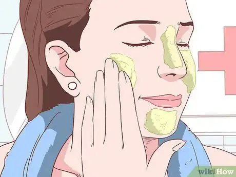 Imagen titulada Get Rid of Acne Without Using Medication Step 20