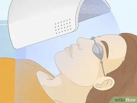 Imagen titulada Get Rid of Fordyce Spots Step 5