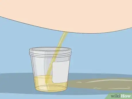 Imagen titulada Help a Female Child Provide a Urine Sample Step 6