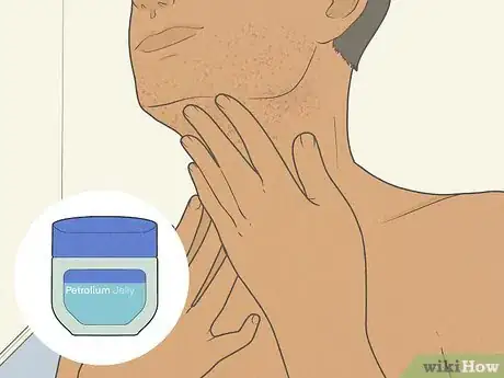 Imagen titulada Get Rid of Razor Burn Fast Step 14