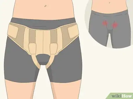 Imagen titulada Treat a Hernia at Home Step 3