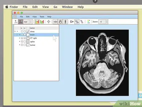 Imagen titulada Read an MRI Step 5