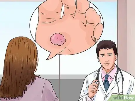 Imagen titulada Heal Blisters Step 14