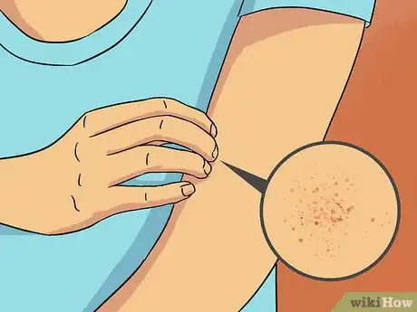 Imagen titulada Use Drysol Step 9