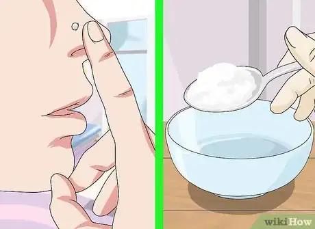 Imagen titulada Get Rid of a Nose Ring Bump Step 7