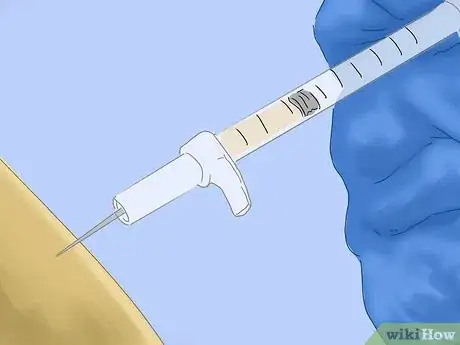 Imagen titulada Identify Measles Step 6