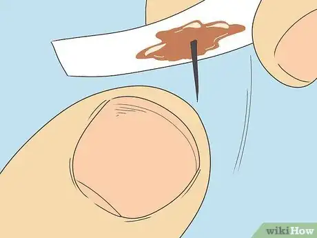 Imagen titulada Remove a Splinter Under Your Fingernail Step 8