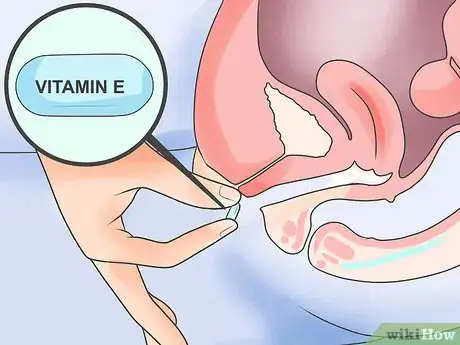 Imagen titulada Treat Vaginal Dryness During Menopause Step 5