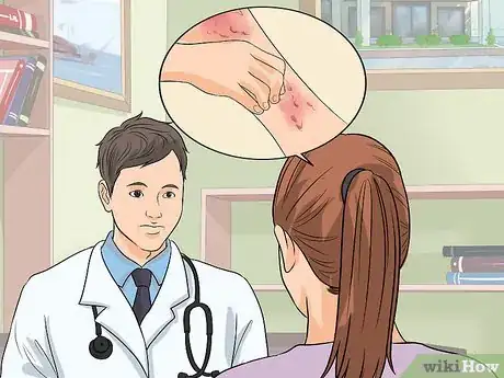 Imagen titulada Treat Cellulitis Step 3