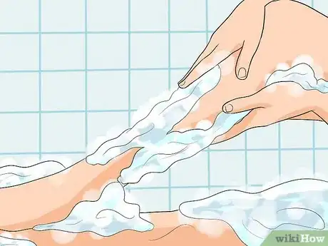 Imagen titulada Treat Cellulitis Step 5