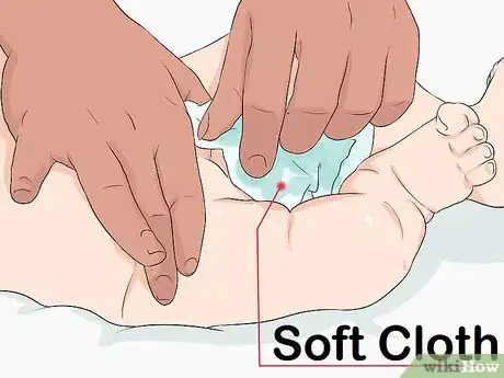 Imagen titulada Clean a Circumcision Step 1