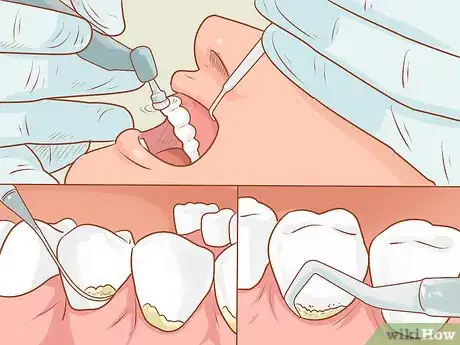 Imagen titulada Grow Gums Back Step 3