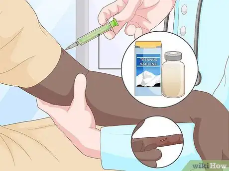 Imagen titulada Splint a Finger Step 10