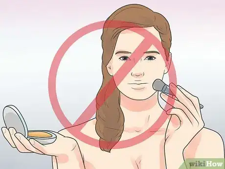 Imagen titulada Recognize an Eyelid Cyst Step 4