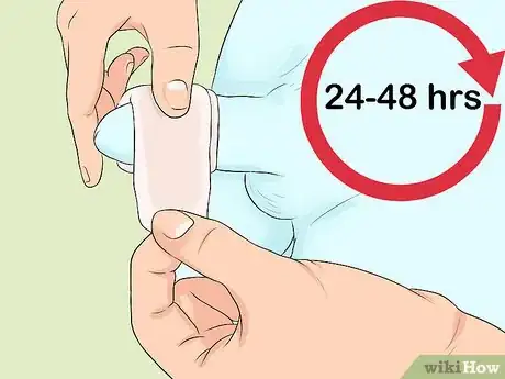Imagen titulada Clean a Circumcision Step 8