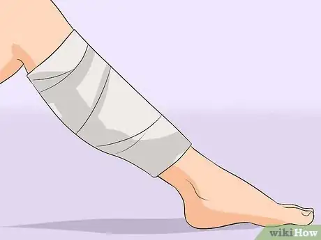 Imagen titulada Treat Cellulitis Step 7