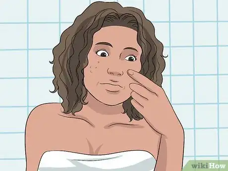 Imagen titulada Get Rid of Acne Redness Step 24