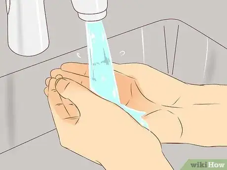 Imagen titulada Treat a Burn Using Honey Step 10