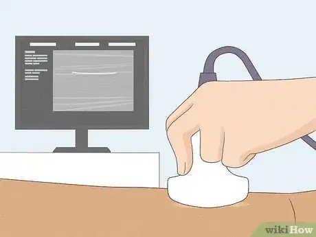 Imagen titulada Remove Nexplanon Step 6
