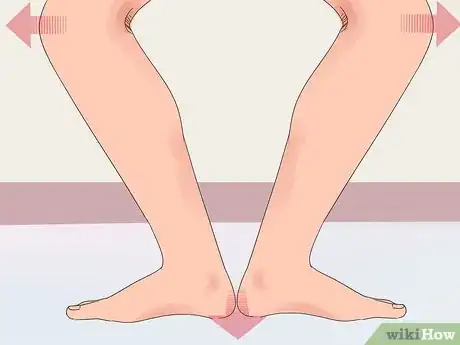 Imagen titulada Fix Pronated Feet Step 5