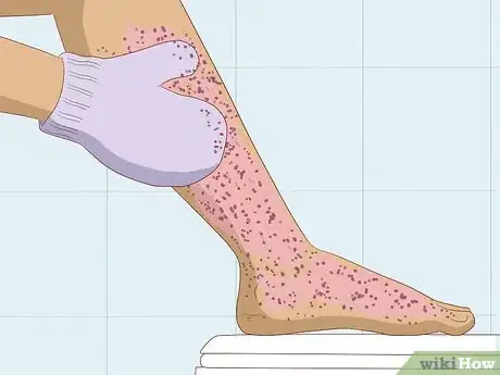 Imagen titulada Make Epilating Hurt Less Step 3