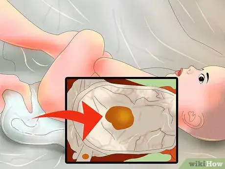 Imagen titulada Treat Diarrhea in Newborns Step 5